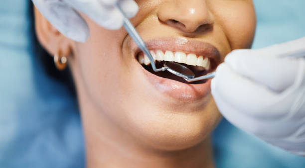 Best Emergency Dental Care for Broken or Chipped Teeth in Millport, AL